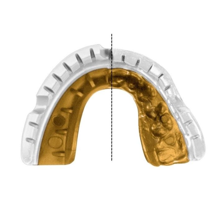 Капа OPRO Gold Braces під брекети доросла (вік 11+) White/Gold (art.102506004) - Зображення 9