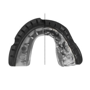 Капа OPRO Gold Braces під брекети доросла (вік 11+) Blackl/Silver(art.102518001) - Зображення 4