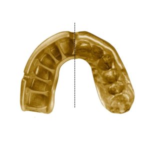 Капа OPRO Gold доросла (вік 11+)  Grillz Black/Gold (art.102504012) - Зображення 3