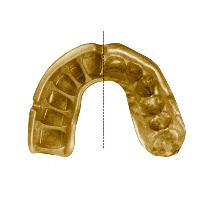 Капа OPRO Gold доросла (вік 11+) Grillz Black/Gold (art.102504012) - Зображення 3