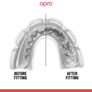 Капа OPRO Instant Single Colour Braces доросла (вік 11+) Clear (art.102522007) - Зображення 4